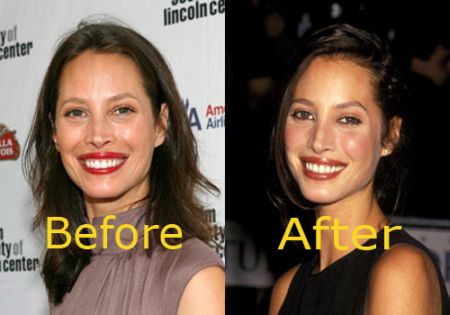 Christy Turlington nose job before and after