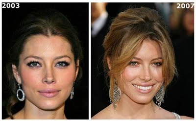 Jessica Biel Nose Job