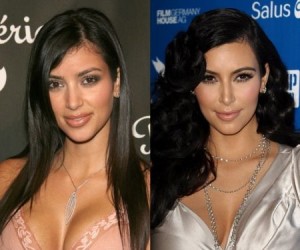 Kim Kardashian Nose Job – Good or Bad Nose Job?