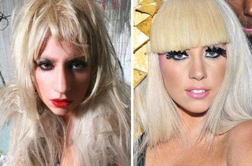 Lady Gaga nose job before after