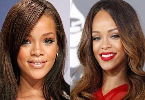 Rihanna Nose Job Before and After