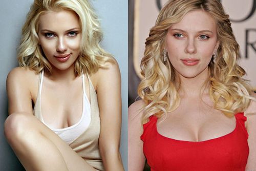 Scarlett Johansson Breast Implants