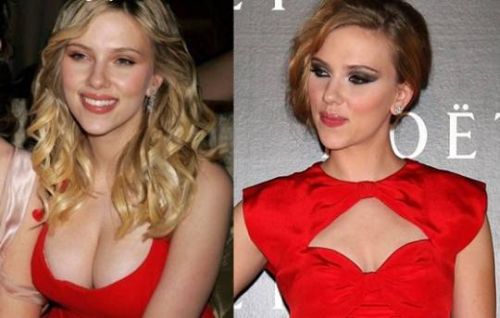 Scarlett Johansson Breast Reduction