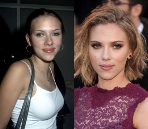 Scarlett Johansson nose job before and after