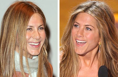 Jennifer Aniston nose job before and after