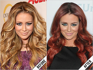Aubrey O'Day Plastic Surgery before and after