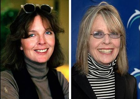 Diane Keaton Plastic Surgery Before After