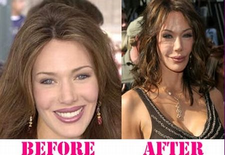 Hunter Tylo plastic surgery before and after