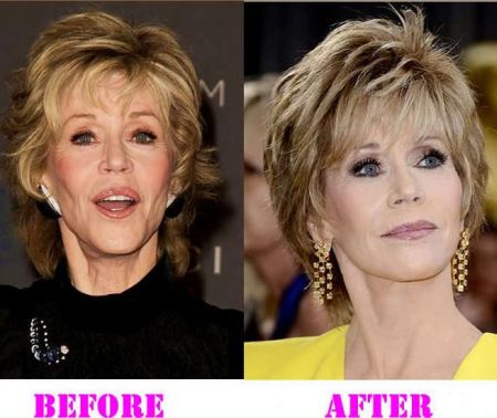 Jane Fonda plastic surgery before and after