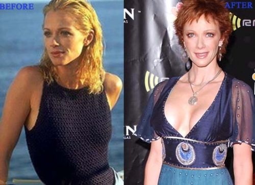 Lauren Holly plastic surgery (breast implants)