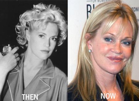 Melanie Griffith plastic surgery before and after