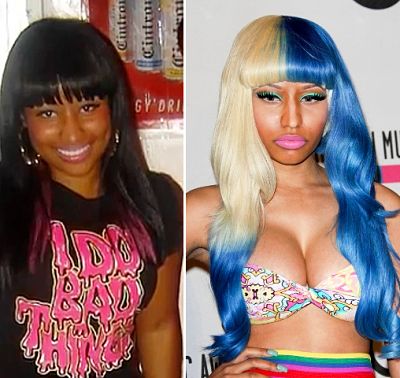 Nicki Minaj Plastic Surgery Before and After