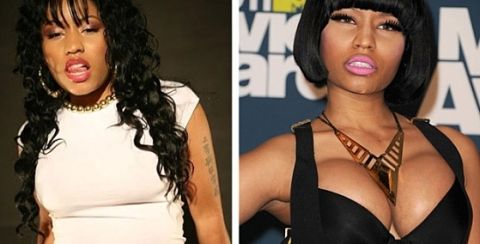 Nicki Minajnicki breast implants before and after