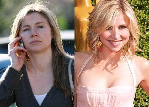 Sarah Chalke Plastic Surgery