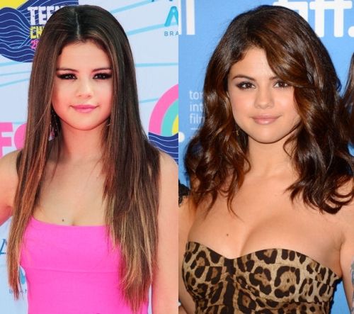 Selena Gomez breast implants before and after