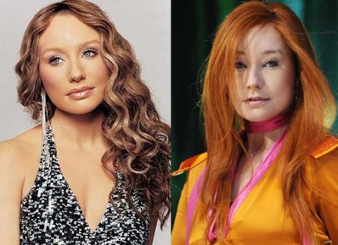 Tori Amos Plastic Surgery Before After