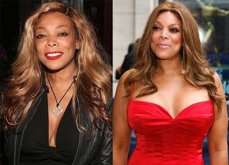 Wendy Williams breast implants before and after