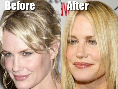 Daryl Hannah plastic surgery before and after