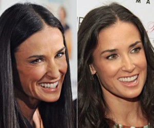 Demi Moore plastic surgery before and after