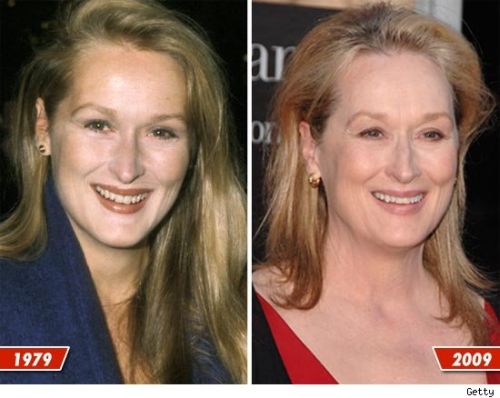 Meryl Streep Plastic Surgery Before and After