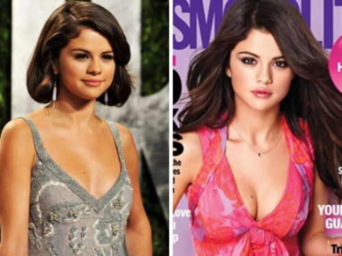 Selena Gomez plastic surgery