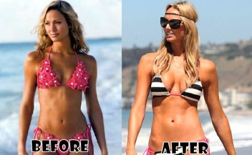 Stacy Keibler plastic surgery before and after