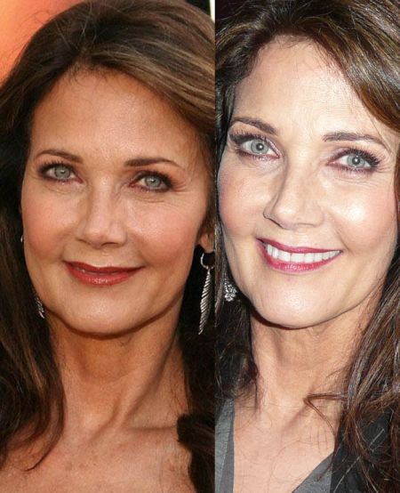 Lynda Carter plastic surgery before and after