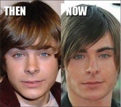 Zac Efron plastic surgery