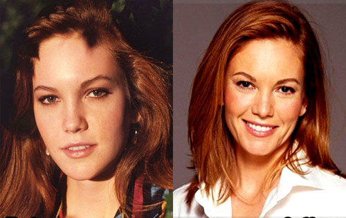 Diane Lane Plastic Surgery Rumors True? 