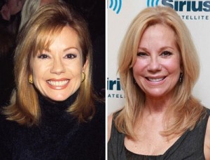 Kathie Lee Gifford Plastic Surgery - Her Personal Confession