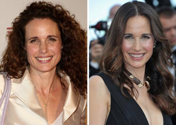 andie macdowell plastic surgery before and after