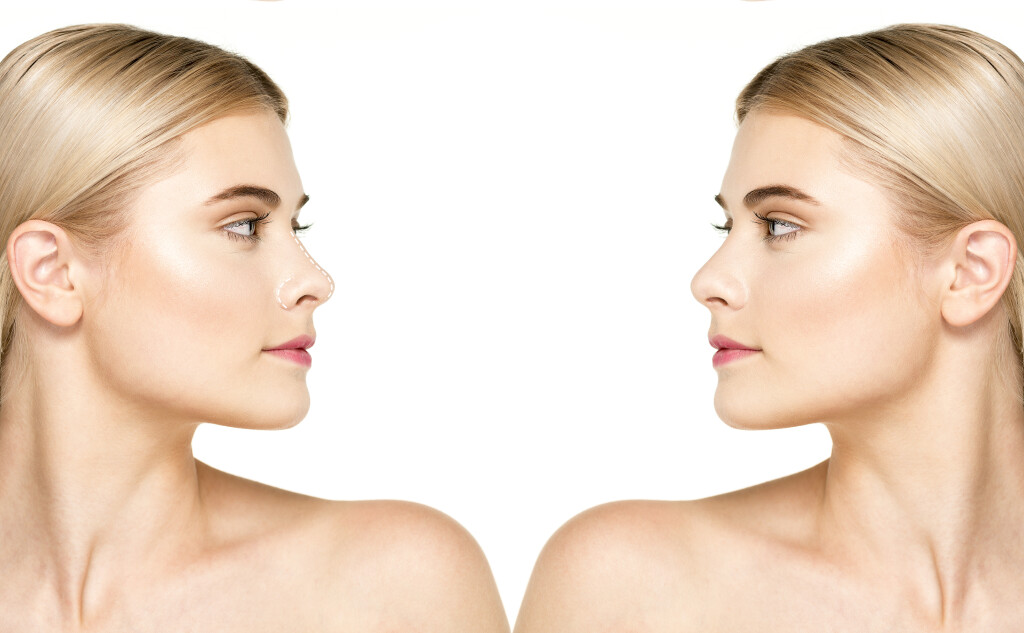 Sze plastic surgery before and after surgery