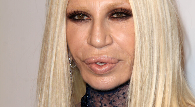Donatella Versace plastic surgery before and
