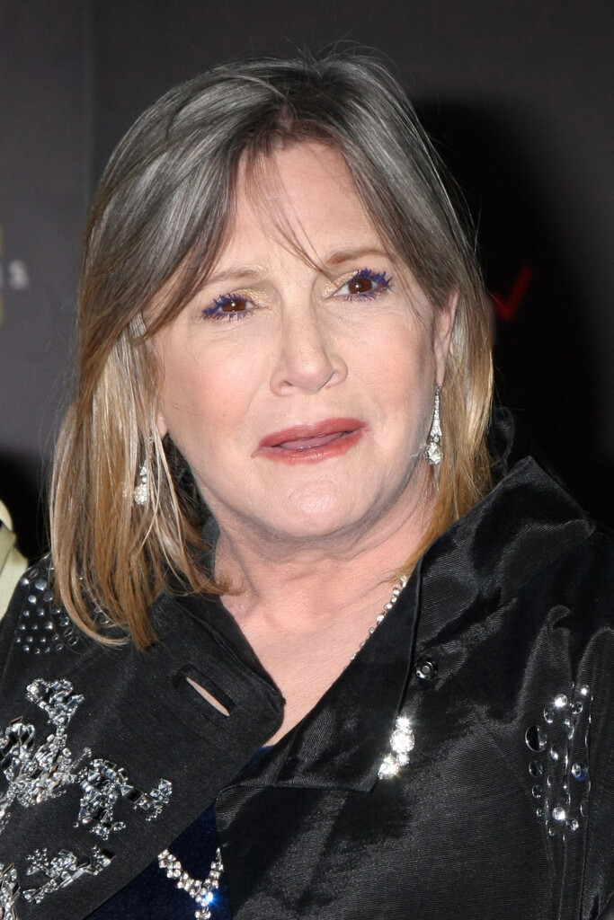 Carrie fisher: Plastic Surgery before and after